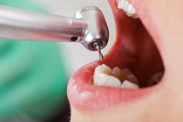 Best Emergency Broken Tooth Repair in East Dubuque, IL